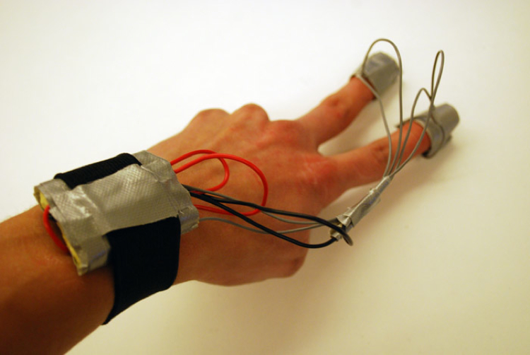 Almost Genius: Robotic Arm Cuff Works Like a Wearable Therapist