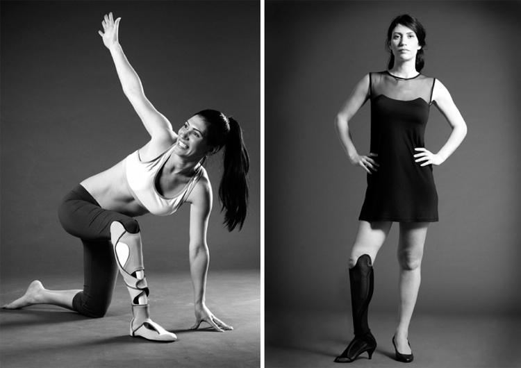 woman beautiful prosthetic leg